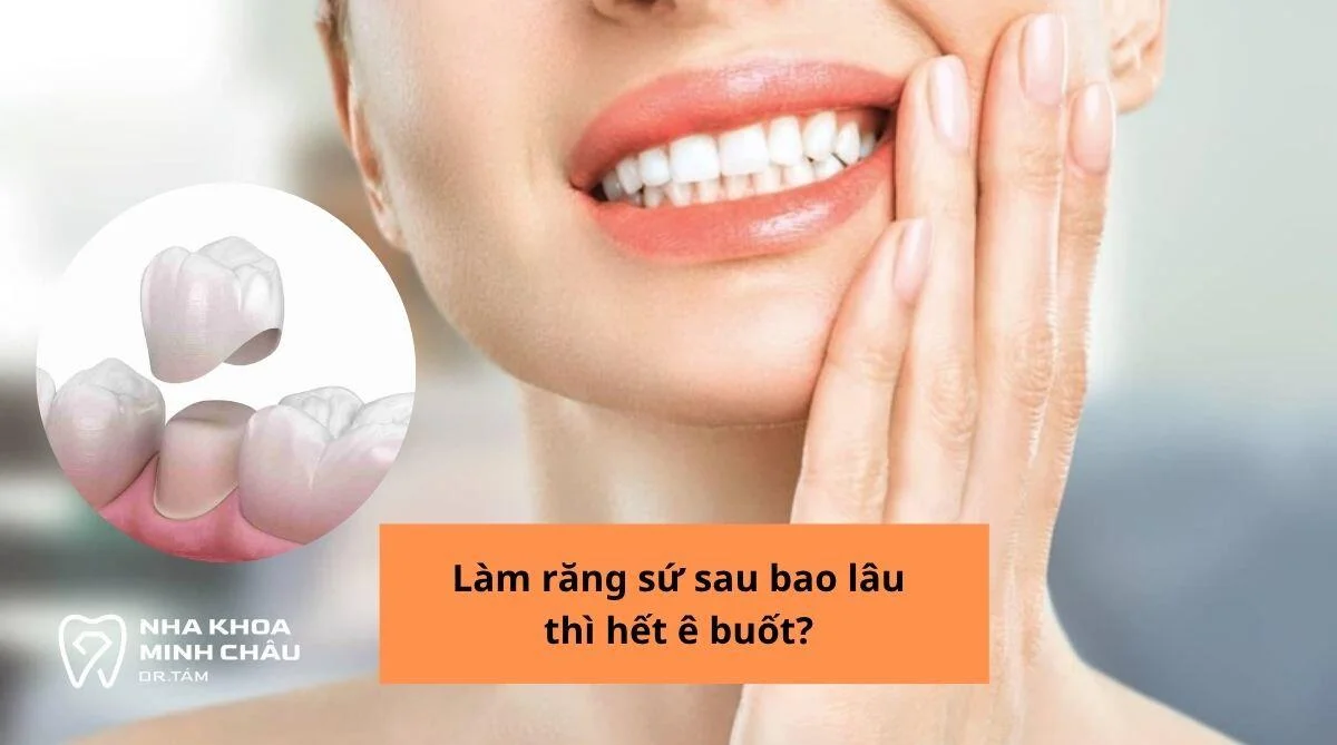 Làm răng sứ sau bao lâu thì hết ê buốt? Giải đáp A-Z từ chuyên gia