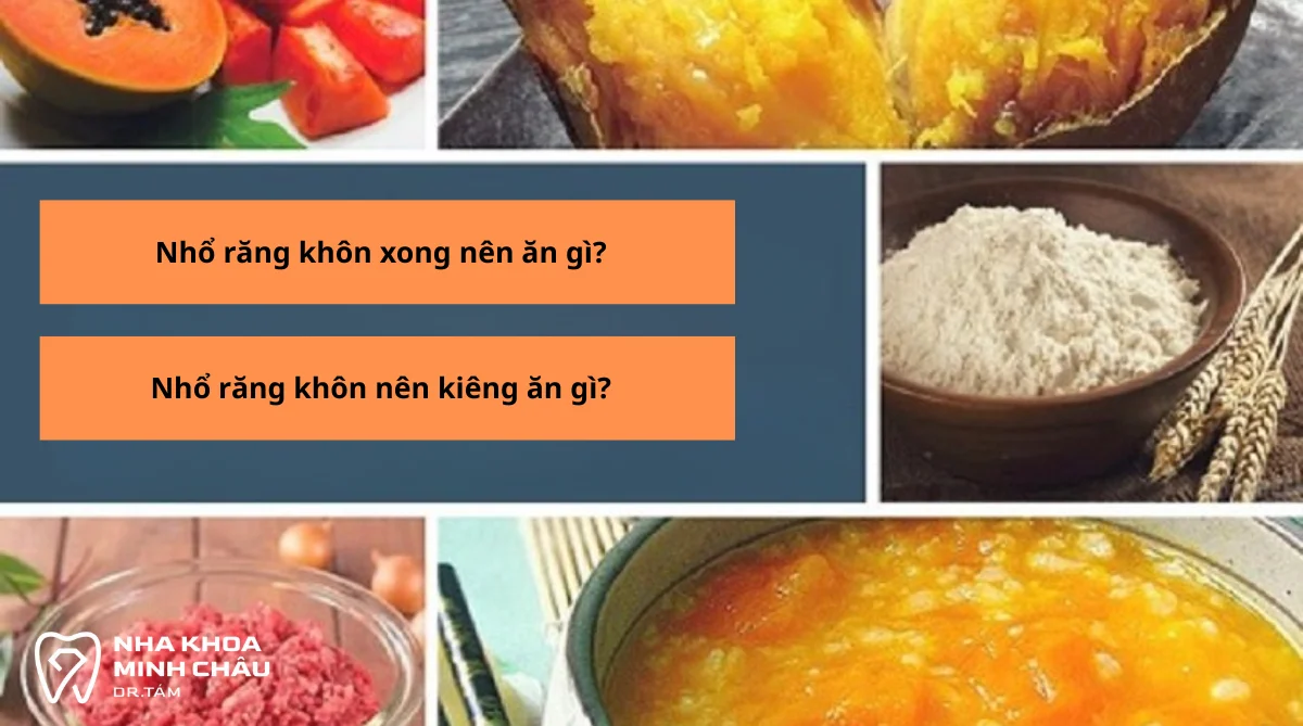 Nhổ răng khôn xong nên ăn gì? Thực đơn phục hồi nhanh, an toàn
