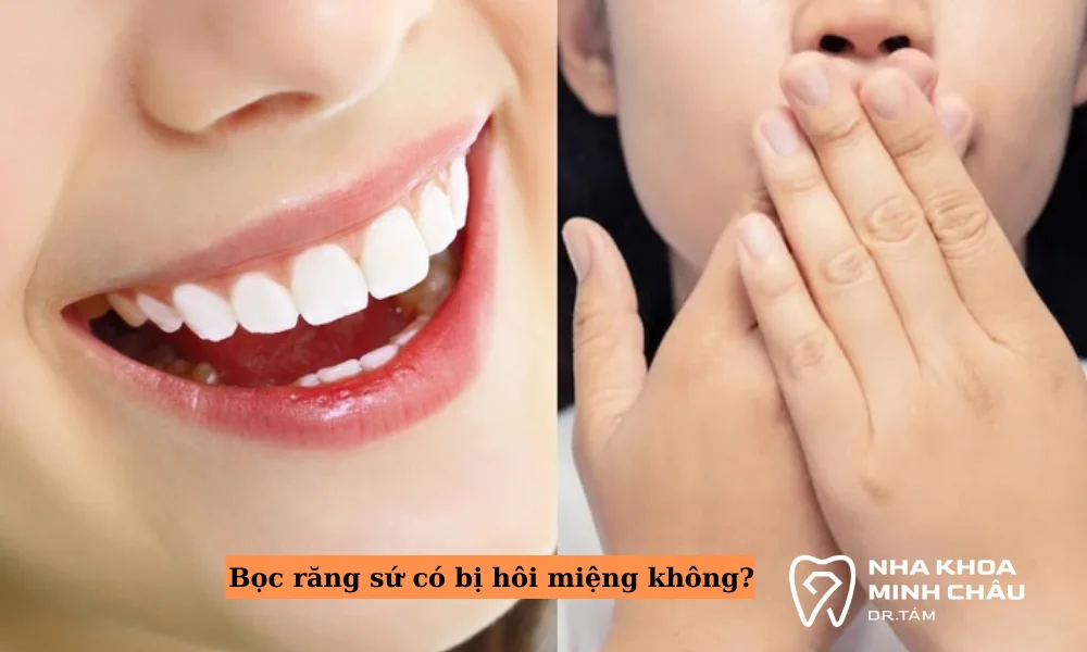 Bọc răng sứ có bị hôi miệng không?