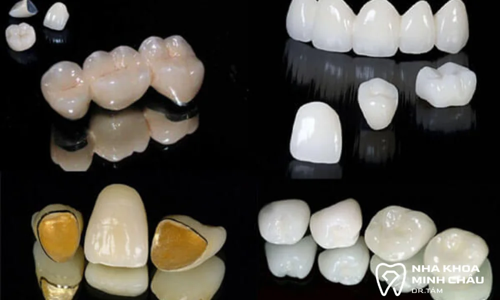 Các loại răng sứ phổ biến nhất 2025