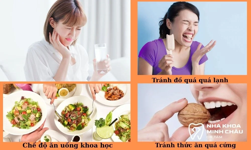 Cách chăm sóc răng sau khi dán Veneer