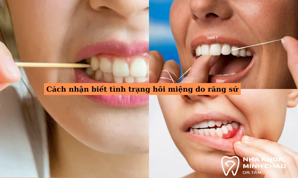 Cách nhận biết tình trạng hôi miệng do răng sứ