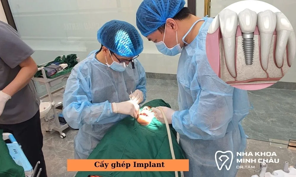 cay-ghep-implant-dr-tam-1
