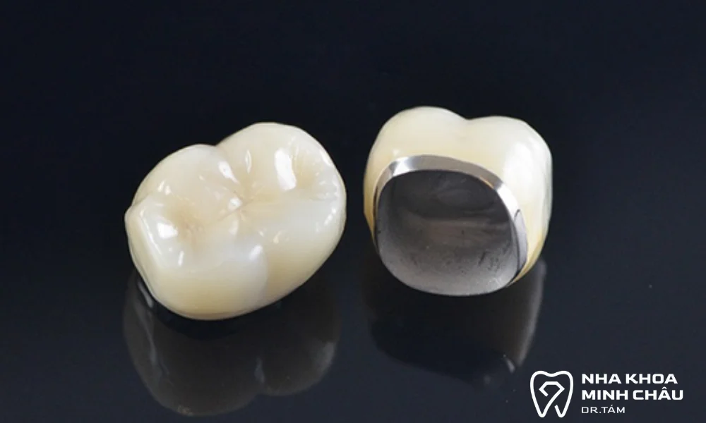 Chất liệu răng sứ giá rẻ