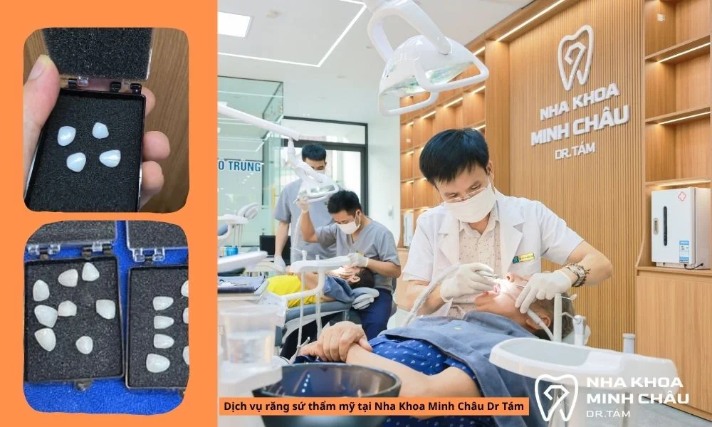 Bọc răng sứ thẩm mỹ