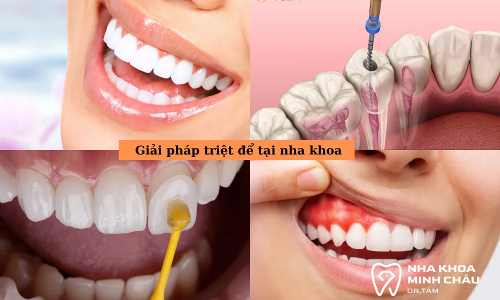 Giải pháp triệt để tại nha khoa