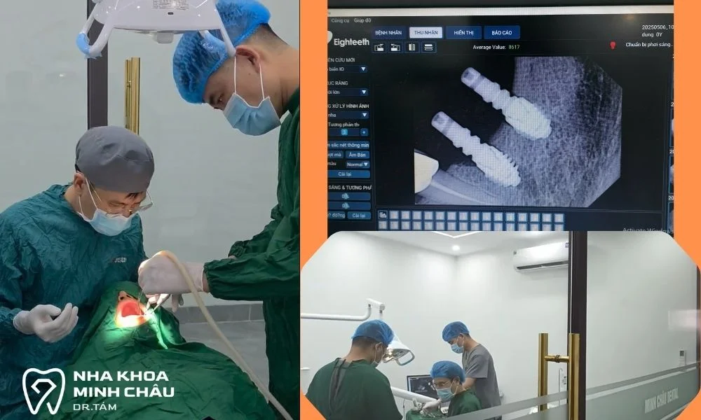 Cấy ghép Implant chuyên nghiệp tại DR Tám