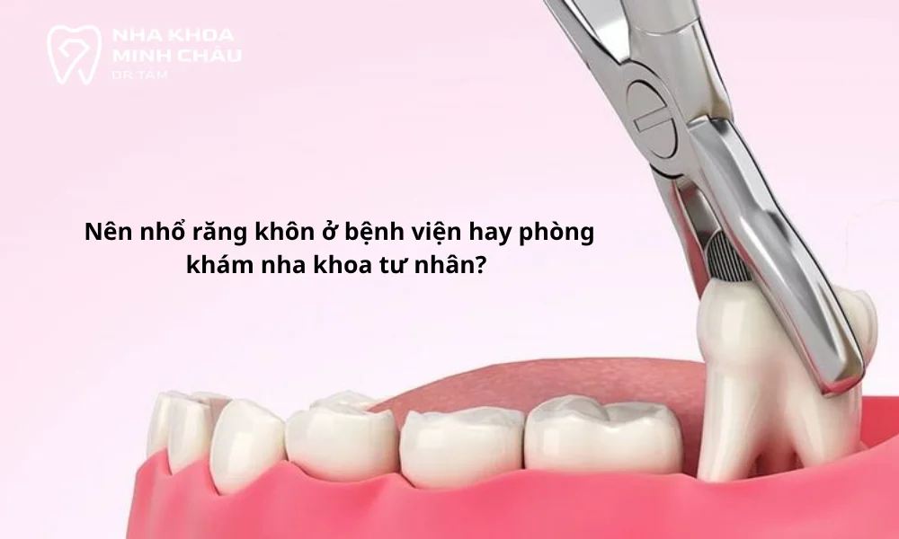 Nên nhổ răng khôn ở đâu?