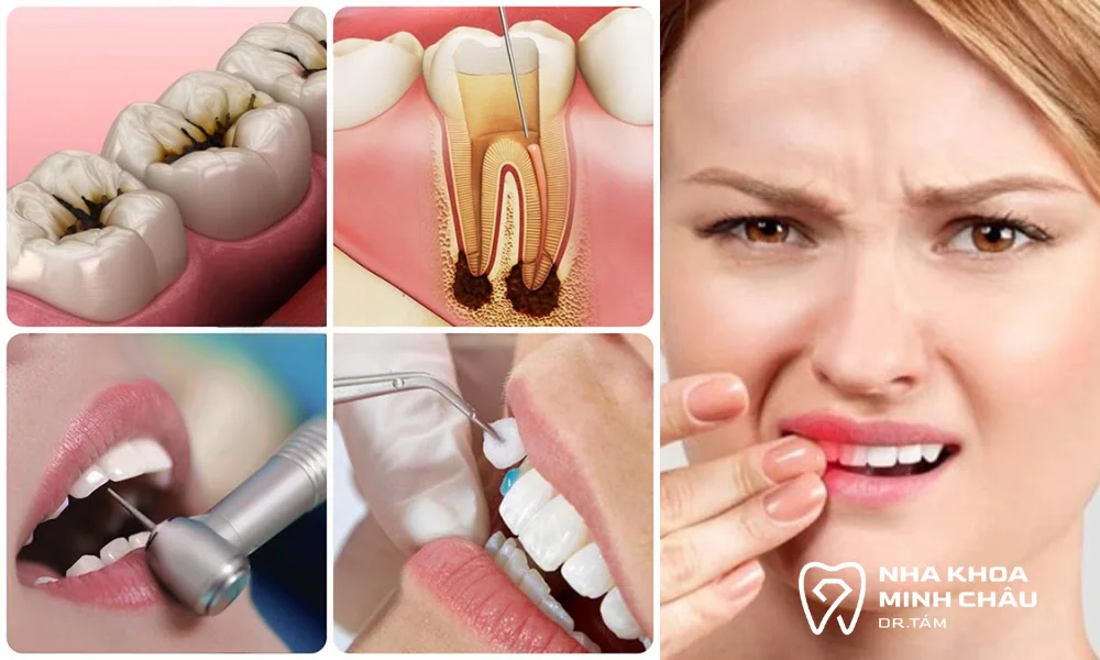 Nguyên nhân khiến bọc răng sứ bị nhức 