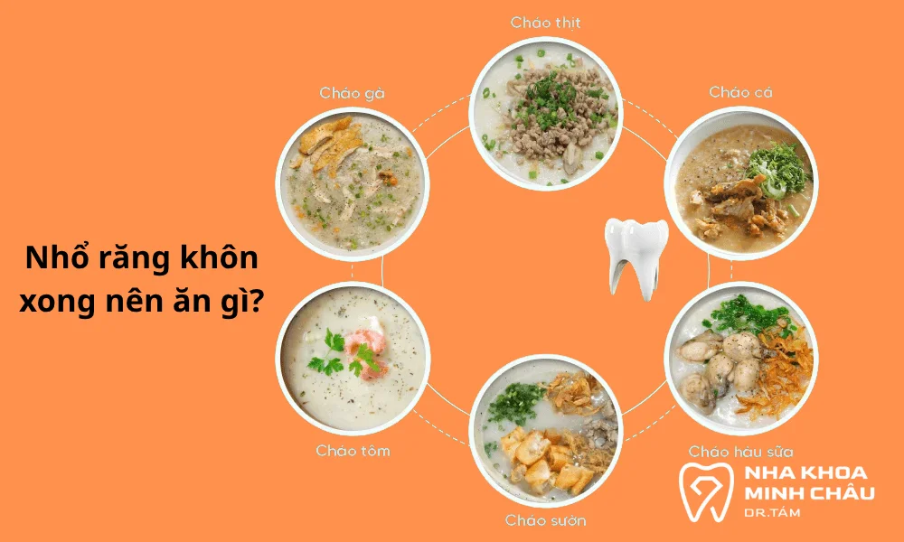 nhổ răng khôn xong nên ăn gì