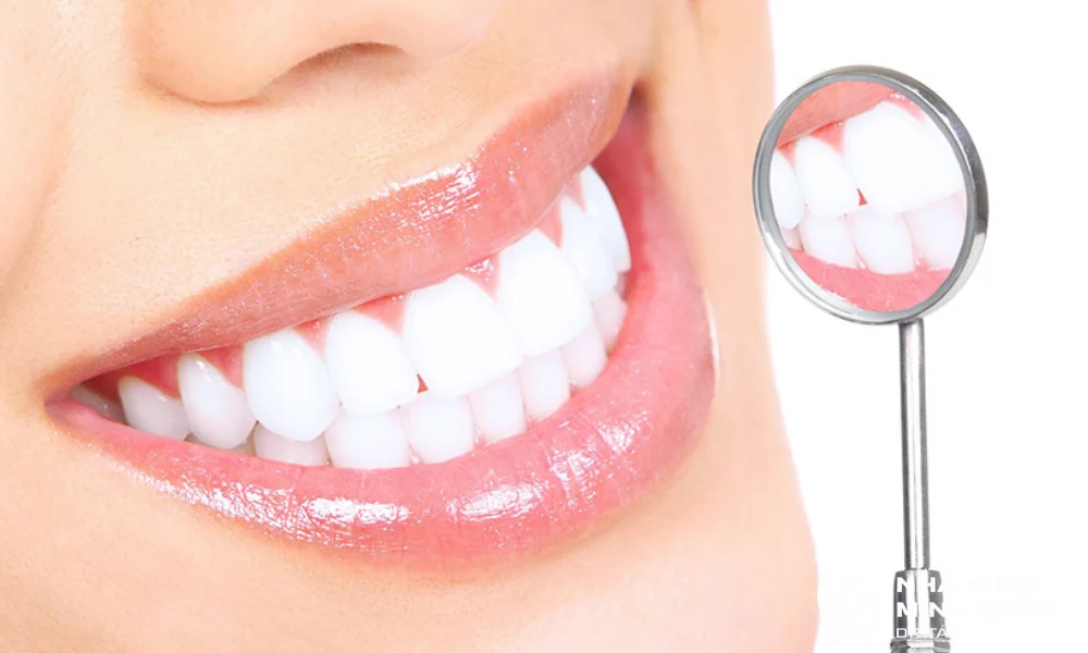 Những lợi ích tuyệt vời khi bọc răng sứ