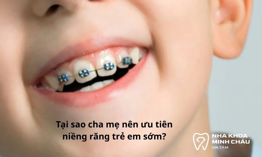 Niềng răng trẻ em sớm