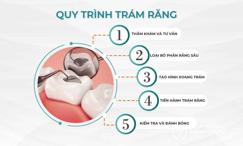 quy-trinh-han-rang-1