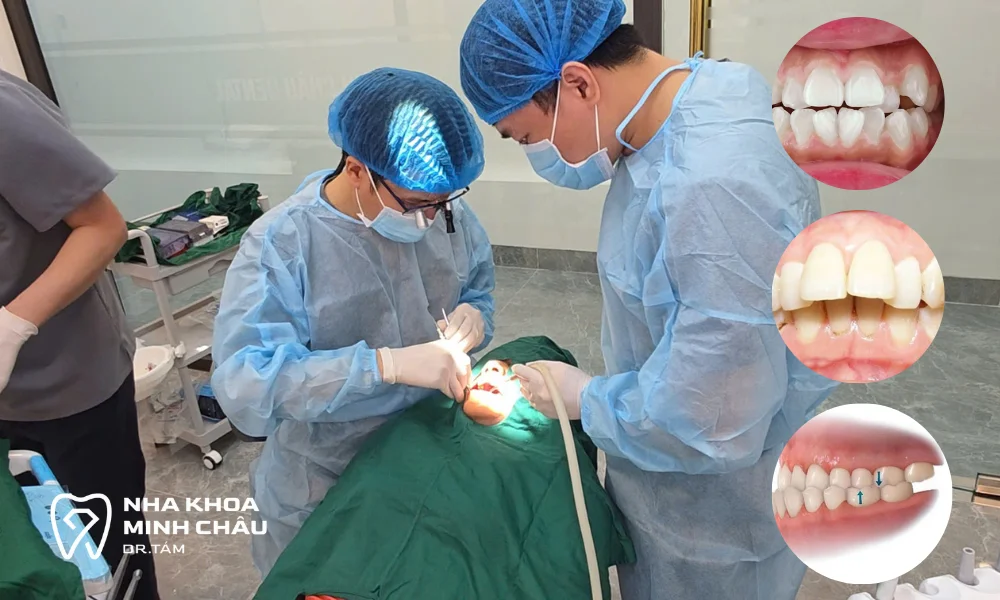 truong-hop-nen-nieng-rang